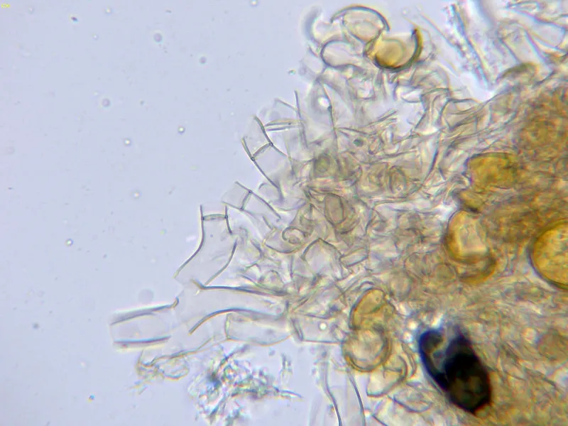 Botryobasidium simile 10 - Hifas conidiógenas agua-003
